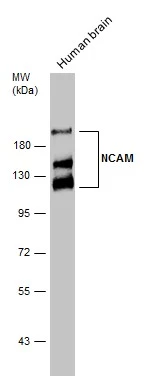 Human tissue extract (30 μg) was separated by 7.5% SDS-PAGE, and the membrane was blotted with NCAM antibody (GTX111684) diluted at 1:10000. The HRP-conjugated anti-rabbit IgG antibody (GTX213110-01) was used to detect the primary antibody.