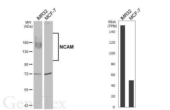 Various whole cell extracts (50 μg) were separated by 7.5% SDS-PAGE, and the membrane was blotted with NCAM antibody (GTX111684) diluted at 1:1000. The HRP-conjugated anti-rabbit IgG antibody (GTX213110-01) was used to detect the primary antibody. Corresponding RNA expression data are based on Human Protein Atlas program.
