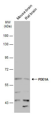 Various tissue extracts (50 μg) were separated by 7.5% SDS-PAGE, and the membrane was blotted with PDE1A antibody (GTX111687) diluted at 1:500. The HRP-conjugated anti-rabbit IgG antibody (GTX213110-01) was used to detect the primary antibody.