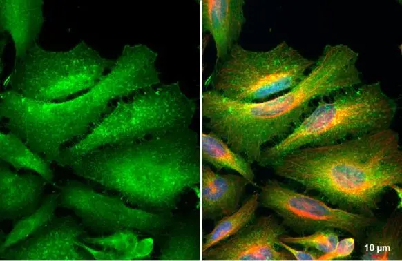Ezrin antibody [N2C2], Internal detects Ezrin protein at cell membrane by immunofluorescent analysis. Sample: HeLa cells were fixed in 4% paraformaldehyde at RT for 15 min. Green: Ezrin stained by Ezrin antibody [N2C2], Internal (GTX111709) diluted at 1:500. Red: alpha Tubulin, a cytoskeleton marker, stained by alpha Tubulin antibody [GT114] (GTX628802) diluted at 1:1000. Blue: Fluoroshield with DAPI (GTX30920).