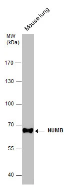 Mouse tissue extract (50 μg) was separated by 7.5% SDS-PAGE, and the membrane was blotted with NUMB antibody [N1N3] (GTX111715) diluted at 1:1000.