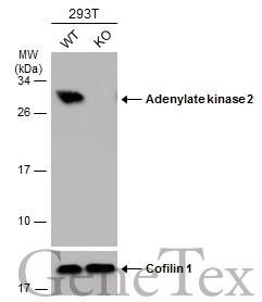 Wild-type (WT) and Adenylate kinase 2 knockout (KO) 293T cell extracts (30 μg) were separated by 12% SDS-PAGE, and the membrane was blotted with Adenylate kinase 2 antibody (GTX111726) diluted at 1:1000. The HRP-conjugated anti-rabbit IgG antibody (GTX213110-01) was used to detect the primary antibody.
