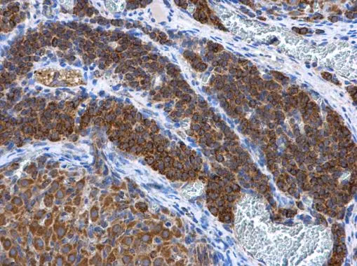 Adenylate kinase 2 antibody [N1C3-2] detects Adenylate kinase 2 protein at mitochondria in rat ovary by immunohistochemical analysis. Sample: Paraffin-embedded rat ovary. Adenylate kinase 2 antibody [N1C3-2] (GTX111737) diluted at 1:500. 
 Antigen Retrieval: Citrate buffer, pH 6.0, 15 min