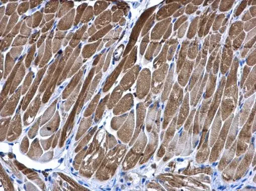 PIP4K2B antibody [N1C1]