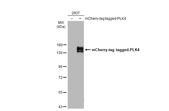 Non-transfected (–) and transfected (+) 293T whole cell extracts (30 μg) were separated by 7.5% SDS-PAGE, and the membrane was blotted with PLK4 antibody (GTX111754) diluted at 1:5000. The HRP-conjugated anti-rabbit IgG antibody (GTX213110-01) was used to detect the primary antibody.