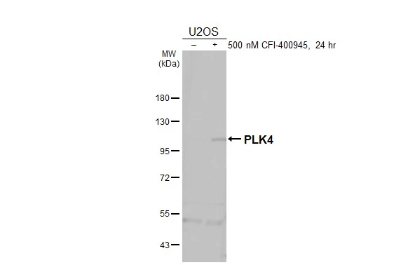 Untreated (–) and treated (+) U2OS whole cell extract (30 μg) were separated by 7.5% SDS-PAGE, and the membrane was blotted with PLK4 antibody (GTX111754) diluted at 1:1000. The HRP-conjugated anti-rabbit IgG antibody (GTX213110-01) was used to detect the primary antibody, and the signal was developed with Trident ECL plus-Enhanced.