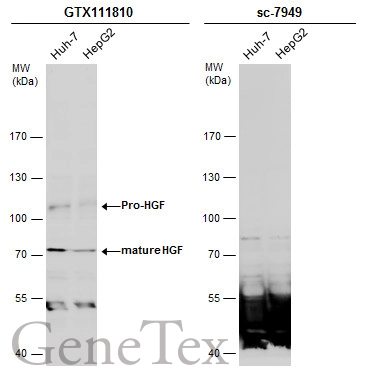Various whole cell extracts (30 μg) were separated by 7.5% SDS-PAGE, and the membranes were blotted with HGF antibody [N2C1], Internal (GTX111810) diluted at 1:500 and competitor's antibody (sc-7949) diluted at 1:100. The HRP-conjugated anti-rabbit IgG antibody (GTX213110-01) was used to detect the primary antibody, and the signal was developed with Trident ECL plus-Enhanced.
