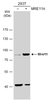 Non-transfected (–) and transfected (+) 293T whole cell extracts (30 μg) were separated by 7.5% SDS-PAGE, and the membrane was blotted with Mre11 antibody [C1C3-2] (GTX111814) diluted at 1:1000. The HRP-conjugated anti-rabbit IgG antibody (GTX213110-01) was used to detect the primary antibody.
