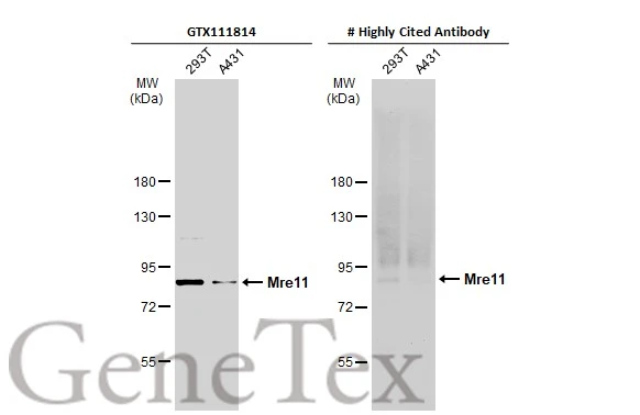 Various whole cell extracts (30 μg) were separated by 7.5% SDS-PAGE, and the membranes were blotted with Mre11 antibody [C1C3-2] (GTX111814) diluted at 1:1000 and competitor's antibody diluted at 1:1000. The HRP-conjugated anti-rabbit IgG antibody (GTX213110-01) was used to detect the primary antibody. *The competitor is not affiliated with GeneTex and does not endorse this product.