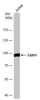 Whole cell extract (30 μg) was separated by 7.5% SDS-PAGE, and the membrane was blotted with SSRP1 antibody [N1N3] (GTX111816) diluted at 1:1000. The HRP-conjugated anti-rabbit IgG antibody (GTX213110-01) was used to detect the primary antibody.