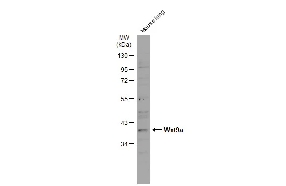 Mouse tissue extract (50 μg) was separated by 10% SDS-PAGE, and the membrane was blotted with Wnt9a antibody [N1N2], N-term (GTX111855) diluted at 1:500. The HRP-conjugated anti-rabbit IgG antibody (GTX213110-01) was used to detect the primary antibody, and the signal was developed with Trident ECL plus-Enhanced.