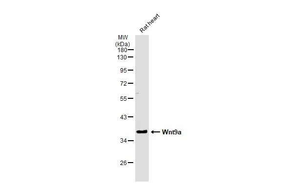 Rat tissue extract (50 μg) was separated by 10% SDS-PAGE, and the membrane was blotted with Wnt9a antibody [N1N2], N-term (GTX111855) diluted at 1:500. The HRP-conjugated anti-rabbit IgG antibody (GTX213110-01) was used to detect the primary antibody.