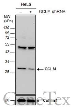 Non-transfected (–) and transfected (+) HeLa whole cell extracts (30 μg) were separated by 12% SDS-PAGE, and the membrane was blotted with GCLM antibody [N1N3] (GTX111858) diluted at 1:7000. The HRP-conjugated anti-rabbit IgG antibody (GTX213110-01) was used to detect the primary antibody.