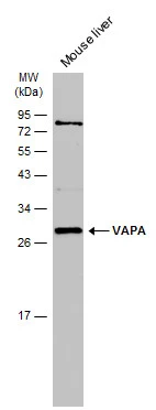 Mouse tissue extract (50 μg) was separated by 12% SDS-PAGE, and the membrane was blotted with VAPA antibody [N1N3] (GTX111859) diluted at 1:1000. The HRP-conjugated anti-rabbit IgG antibody (GTX213110-01) was used to detect the primary antibody.
