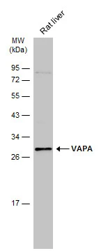 Rat tissue extract (50 μg) was separated by 12% SDS-PAGE, and the membrane was blotted with VAPA antibody [N1N3] (GTX111859) diluted at 1:1000. The HRP-conjugated anti-rabbit IgG antibody (GTX213110-01) was used to detect the primary antibody.