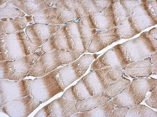 NDUFB6 antibody detects NDUFB6 protein at cytoplasm in rat muscle by immunohistochemical analysis. Sample: Paraffin-embedded rat muscle. NDUFB6 antibody (GTX111880) diluted at 1:500. 
 Antigen Retrieval: Citrate buffer, pH 6.0, 15 min