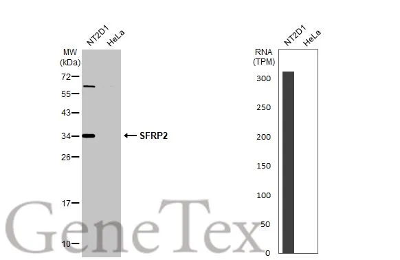 Various whole cell extracts (30 μg) were separated by 12% SDS-PAGE, and the membrane was blotted with SFRP2 antibody [C2C3], C-term (GTX111892) diluted at 1:500. The HRP-conjugated anti-rabbit IgG antibody (GTX213110-01) was used to detect the primary antibody. Corresponding RNA expression data for the same cell lines are based on Human Protein Atlas program.