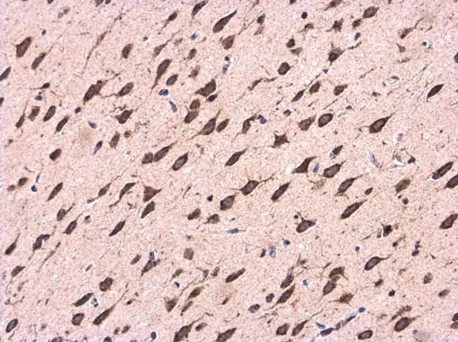 CDK5RAP1 antibody detects CDK5RAP1 protein at cytoplasm in Rat brain by immunohistochemical analysis. Sample: Paraffin-embedded Rat brain. CDK5RAP1 antibody (GTX111910) diluted at 1:500.
Antigen Retrieval: Citrate buffer, pH 6.0, 15 min