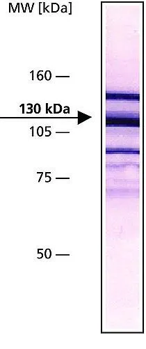 WB analysis of chicken gizzard extract using GTX11193 Vinculin antibody [VIN-11-5] at 1:200.