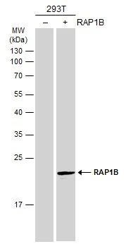 Non-transfected (–) and transfected (+) 293T whole cell extracts (30 μg) were separated by 12% SDS-PAGE, and the membrane was blotted with RAP1B antibody (GTX111933) diluted at 1:1000. The HRP-conjugated anti-rabbit IgG antibody (GTX213110-01) was used to detect the primary antibody.