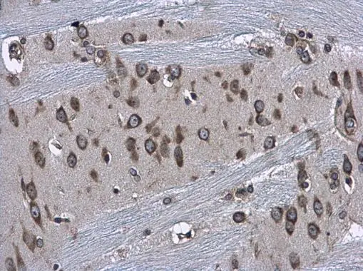RPS3A antibody detects RPS3A protein at cytoplasm and nucleus in rat brain by immunohistochemical analysis. Sample: Paraffin-embedded rat brain. RPS3A antibody (GTX111935) diluted at 1:500. 
 Antigen Retrieval: Citrate buffer, pH 6.0, 15 min