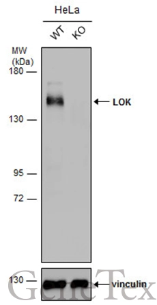 Wild-type (WT) and LOK knockout (KO) HeLa cell extracts (30 μg) were separated by 5% SDS-PAGE, and the membrane was blotted with LOK antibody [N1N2], N-term (GTX111951) diluted at 1:2000. The HRP-conjugated anti-rabbit IgG antibody (GTX213110-01) was used to detect the primary antibody.
