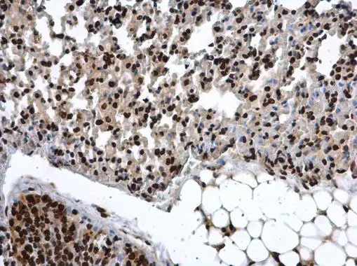 COMMD7 antibody detects COMMD7 protein at nucleus in mouse lung by immunohistochemical analysis. Sample: Paraffin-embedded mouse lung. COMMD7 antibody (GTX112076) diluted at 1:500. 
 Antigen Retrieval: Citrate buffer, pH 6.0, 15 min