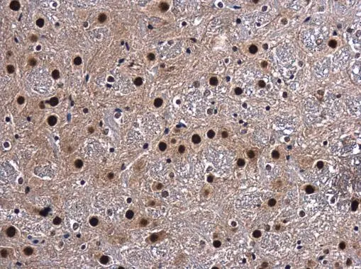CA150 antibody detects CA150 protein at nucleus in mouse brain by immunohistochemical analysis. Sample: Paraffin-embedded mouse brain. CA150 antibody (GTX112099) diluted at 1:500. 
 Antigen Retrieval: Citrate buffer, pH 6.0, 15 min