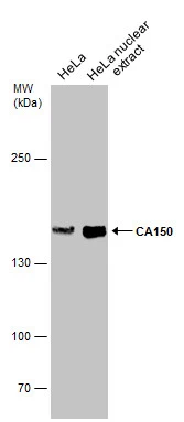 HeLa whole cell and nuclear extracts (30 μg) were separated by 5% SDS-PAGE, and the membrane was blotted with CA150 antibody (GTX112099) diluted at 1:500.