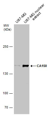 U87-MG whole cell and nuclear extracts (30 μg) were separated by 5% SDS-PAGE, and the membrane was blotted with CA150 antibody (GTX112099) diluted at 1:500.