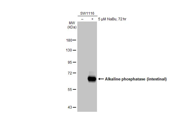 Untreated (–) and treated (+) SW1116 whole cell extract (30 μg) were separated by 7.5% SDS-PAGE, and the membrane was blotted with Alkaline phosphatase (intestinal) antibody (GTX112100) diluted at 1:5000. The HRP-conjugated anti-rabbit IgG antibody (GTX213110-01) was used to detect the primary antibody.