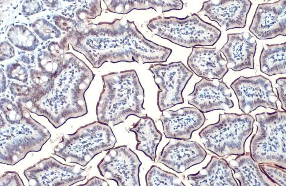 Alkaline phosphatase (intestinal) antibody detects Alkaline phosphatase (intestinal) protein at cell membrane by immunohistochemical analysis. Sample: Paraffin-embedded mouse colon. Alkaline phosphatase (intestinal) stained by Alkaline phosphatase (intestinal) antibody (GTX112100) diluted at 1:500. Antigen Retrieval: Citrate buffer, pH 6.0, 15 min