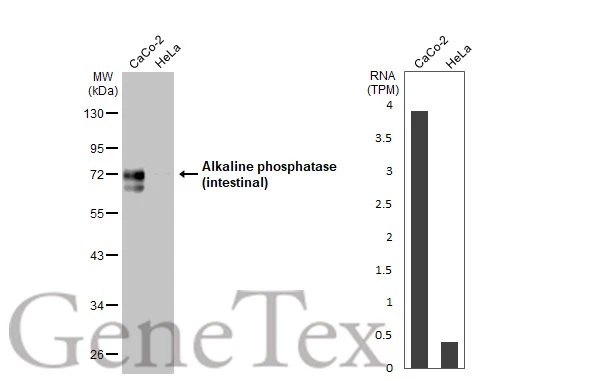 Various whole cell extracts (30 μg) were separated by 10% SDS-PAGE, and the membrane was blotted with Alkaline phosphatase (intestinal) antibody (GTX112100) diluted at 1:1000. The HRP-conjugated anti-rabbit IgG antibody (GTX213110-01) was used to detect the primary antibody. Corresponding RNA expression data for the same cell lines are based on Human Protein Atlas program.