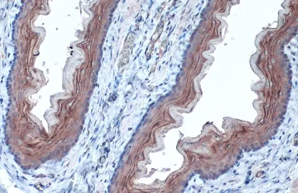 Anti-alpha Tubulin antibody (GTX112141) | GeneTex Anti-alpha Tubulin antibody (GTX112141) | GeneTex