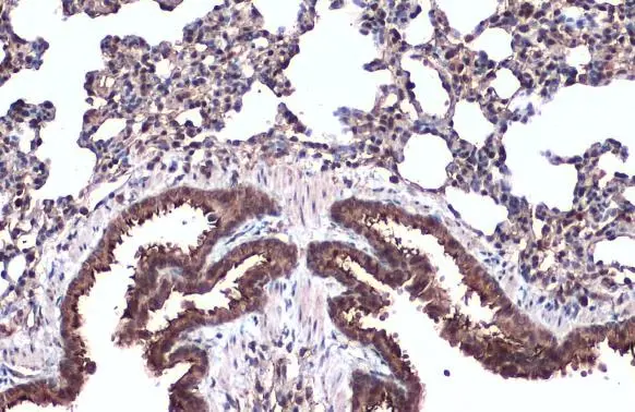 Anti-alpha Tubulin antibody (GTX112141) | GeneTex Anti-alpha Tubulin antibody (GTX112141) | GeneTex