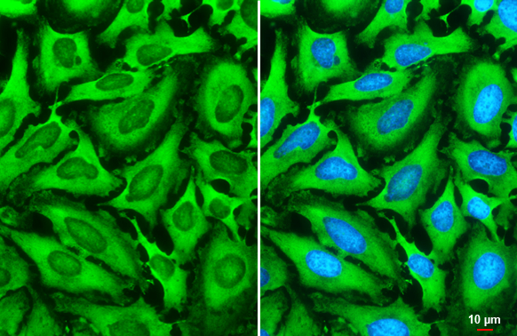 G3BP1 antibody detects G3BP1 protein at cytoplasm by immunofluorescent analysis. Sample: HeLa cells were fixed in 4% paraformaldehyde at RT for 15 min. Green: G3BP1 stained by G3BP1 antibody (GTX112191) diluted at 1:2000. Blue: Fluoroshield with DAPI (GTX30920). Scale bar= 10 μm.