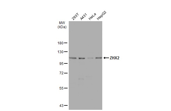 Immunohistochemical analysis of paraffin-embedded SAS Xenograft ,using ZHX2(GTX112232) antibody at 1:100 dilution. Antigen Retrieval: Trilogy? (EDTA based,pH 8.0) buffer,15min