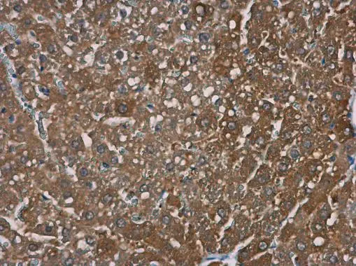 TRPM2 antibody [N1N2-2], N-term detects TRPM2 protein at cytoplasm in rat liver by immunohistochemical analysis. Sample: Paraffin-embedded rat liver. TRPM2 antibody [N1N2-2], N-term (GTX112252) diluted at 1:500. 
 Antigen Retrieval: Citrate buffer, pH 6.0, 15 min