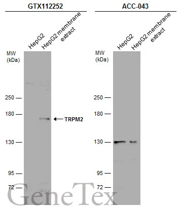HepG2 whole cell and membrane extracts (30 μg) were separated by 5% SDS-PAGE, and the membranes were blotted with TRPM2 antibody [N1N2-2], N-term (GTX112252) diluted at 1:500 and competitor's antibody (ACC-043) diluted at 1:500. The HRP-conjugated anti-rabbit IgG antibody (GTX213110-01) was used to detect the primary antibody. *The competitor is not affiliated with GeneTex and does not endorse this product.