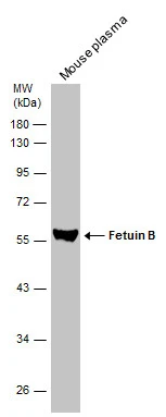 Mouse tissue extract (50 μg) was separated by 10% SDS-PAGE, and the membrane was blotted with Fetuin B antibody (GTX112260) diluted at 1:1000. The HRP-conjugated anti-rabbit IgG antibody (GTX213110-01) was used to detect the primary antibody.