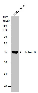Rat tissue extract (50 μg) was separated by 10% SDS-PAGE, and the membrane was blotted with Fetuin B antibody (GTX112260) diluted at 1:1000. The HRP-conjugated anti-rabbit IgG antibody (GTX213110-01) was used to detect the primary antibody.