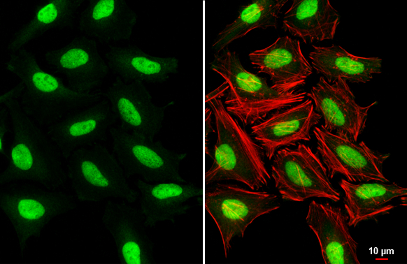 SUV39H1 antibody [N3C3] detects SUV39H1 protein at nucleus by immunofluorescent analysis. Sample: HeLa cells were fixed in 4% paraformaldehyde at RT for 15 min. Green: SUV39H1 stained by SUV39H1 antibody [N3C3] (GTX112263) diluted at 1:500. Red: phalloidin, a cytoskeleton marker, diluted at 1:200. Scale bar= 10 μm.