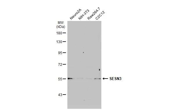 Various whole cell extracts (30 μg) were separated by 7.5% SDS-PAGE, and the membrane was blotted with SESN3 antibody (GTX112277) diluted at 1:500. The HRP-conjugated anti-rabbit IgG antibody (GTX213110-01) was used to detect the primary antibody, and the signal was developed with Trident ECL plus-Enhanced.
