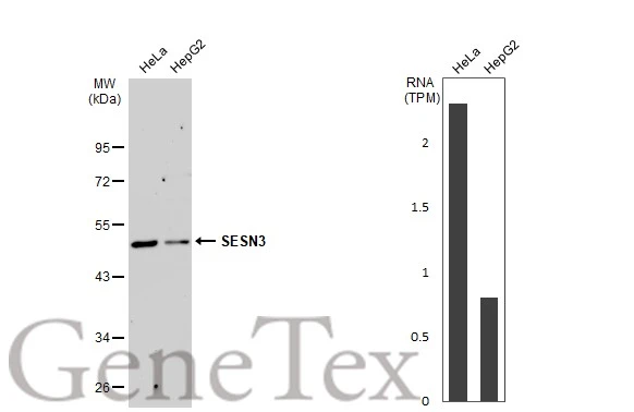 Various whole cell extracts (30 μg) were separated by 10% SDS-PAGE, and the membrane was blotted with SESN3 antibody (GTX112277) diluted at 1:1000. The HRP-conjugated anti-rabbit IgG antibody (GTX213110-01) was used to detect the primary antibody, and the signal was developed with Trident ECL plus-Enhanced.