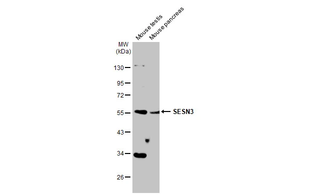 Various tissue extracts (50 μg) were separated by 10% SDS-PAGE, and the membrane was blotted with SESN3 antibody (GTX112277) diluted at 1:1000. The HRP-conjugated anti-rabbit IgG antibody (GTX213110-01) was used to detect the primary antibody.