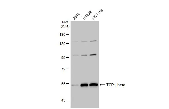Various whole cell extracts (30 μg) were separated by 7.5% SDS-PAGE, and the membrane was blotted with TCP1 beta antibody [C1C3] (GTX112283) diluted at 1:1000. The HRP-conjugated anti-rabbit IgG antibody (GTX213110-01) was used to detect the primary antibody.