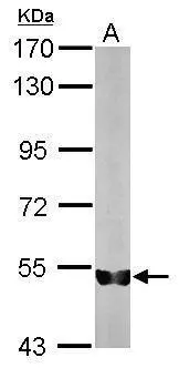 Sample (50 μg of whole cell lysate) A: Mouse brain 7.5% SDS PAGE GTX112284 diluted at 1:1000 The HRP-conjugated anti-rabbit IgG antibody (GTX213110-01) was used to detect the primary antibody.