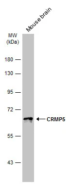 Mouse tissue extract (5 μg) was separated by 7.5% SDS-PAGE, and the membrane was blotted with CRMP5 antibody [N1C1] (GTX112287) diluted at 1:10000. The HRP-conjugated anti-rabbit IgG antibody (GTX213110-01) was used to detect the primary antibody.