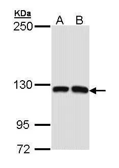 Sample (30 ug of whole cell lysate) A: Molt-4 (GTX27912) B: Raji 5% SDS PAGE GTX112306 diluted at 1:1000 