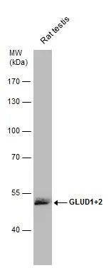 Rat tissue extract (50 μg) was separated by 7.5% SDS-PAGE, and the membrane was blotted with GLUD1 + GLUD2 antibody (GTX112361) diluted at 1:1000. The HRP-conjugated anti-rabbit IgG antibody (GTX213110-01) was used to detect the primary antibody.